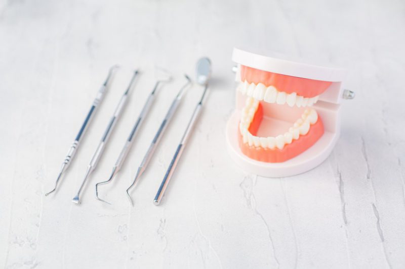 歯医者治療イメージ