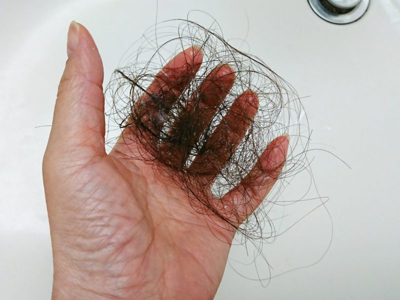 AGA治療の初期脱毛とは｜初期脱毛の原因や起こりやすい時期・軽減する方法も解説します