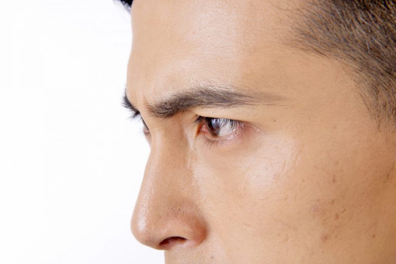 眉のメンズ脱毛の効果とは？眉脱毛の注意点や施術が必要な回数・脱毛の痛み・おすすめな人の特徴もご紹介します