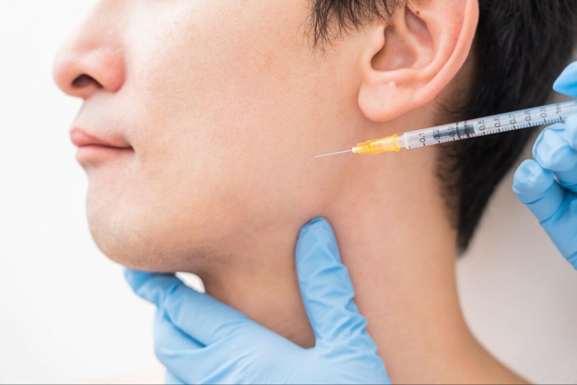 シワはヒアルロン酸で改善できる？部位や注入量の目安、施術が適しているケース