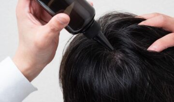 育毛トニックを塗布する男性