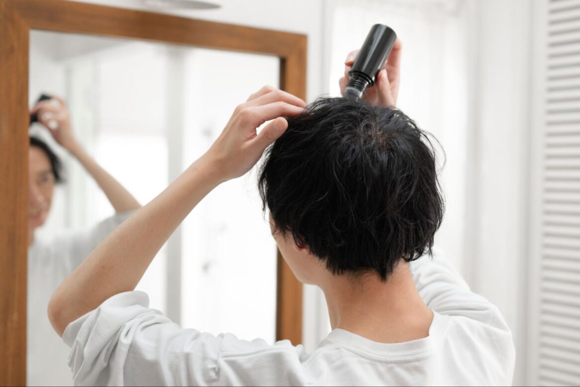 育毛剤を塗布する男性