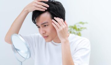 薄毛を気にする男性
