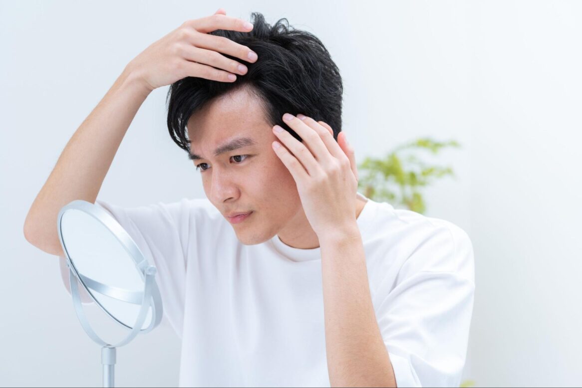 育毛剤で抜け毛が増えたかも？髪の毛が抜ける原因や対策について