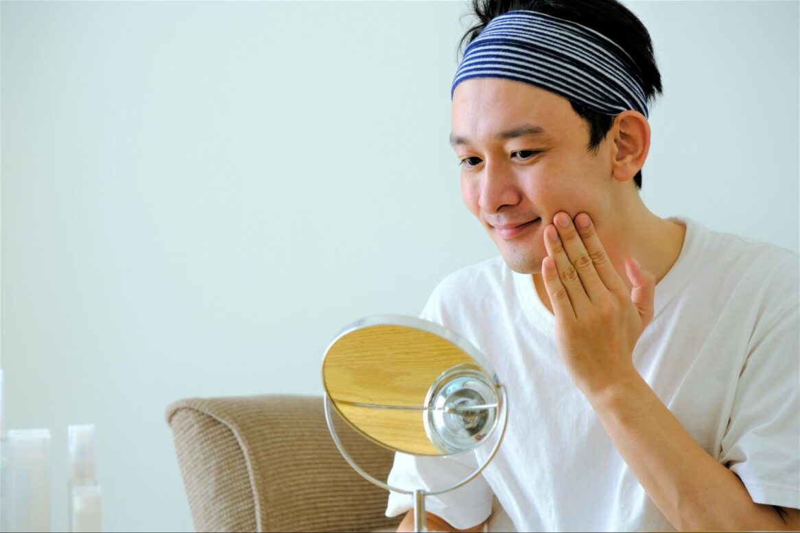 ヒアルロン酸 マリオネットライン