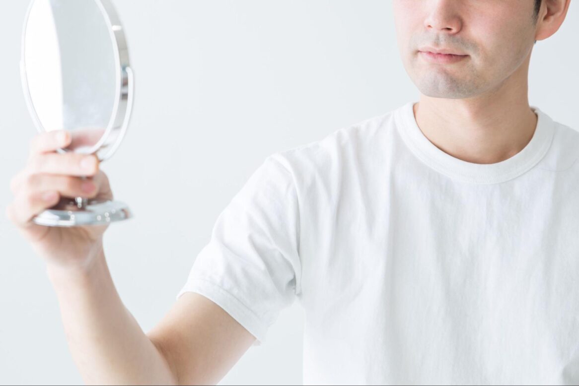 ヒアルロン酸 眉間