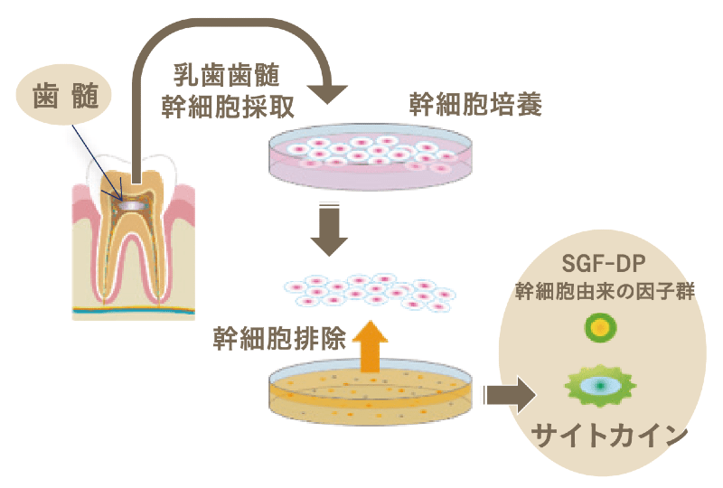 歯髄幹細胞培養上清液について