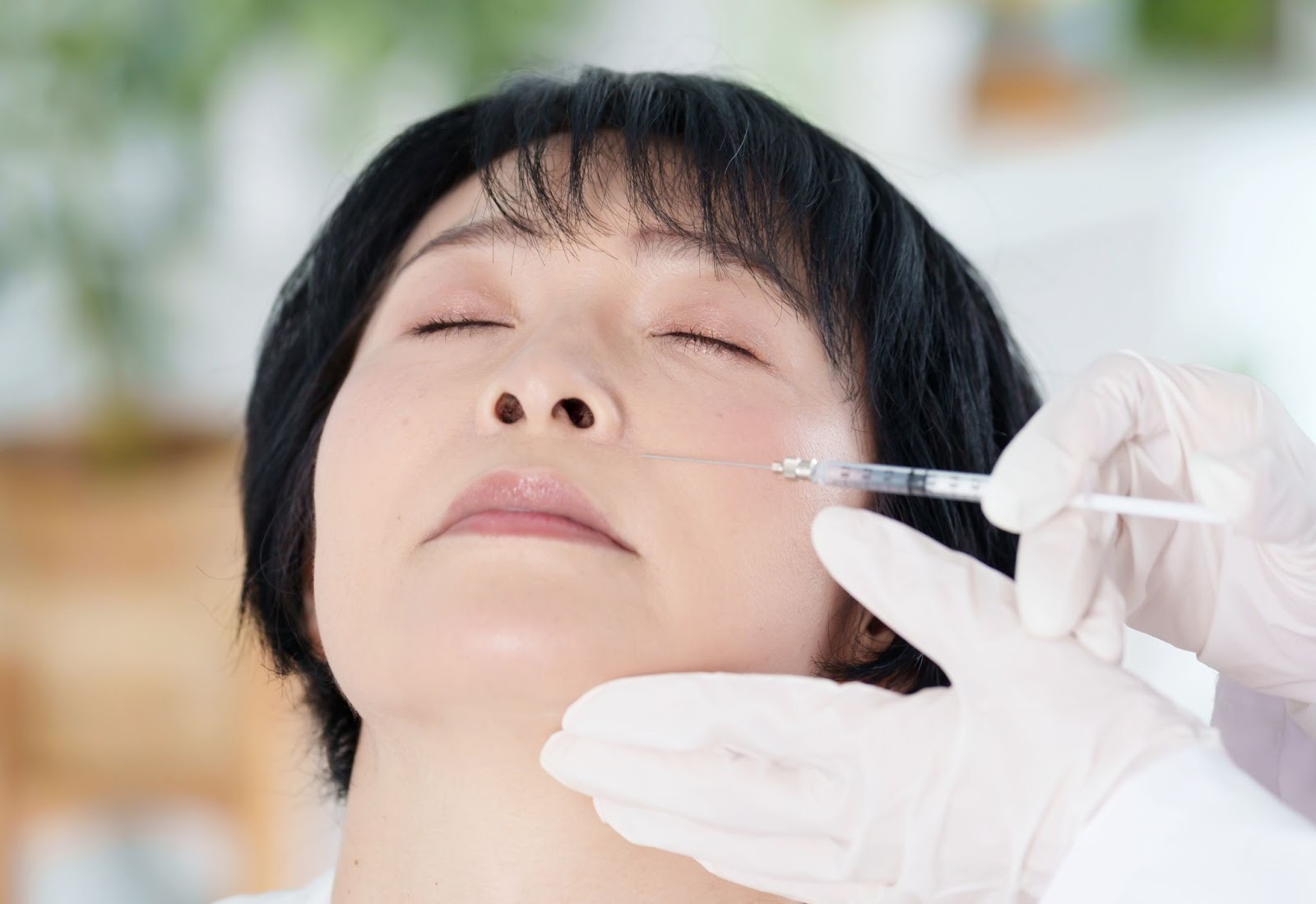 ヒアルロン酸注入によるたるみ治療を受ける女性