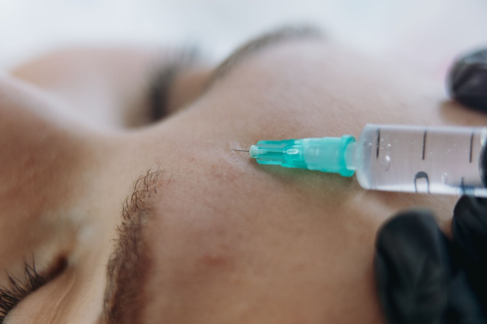 おでこのしわを消すための美容医療を受けている女性