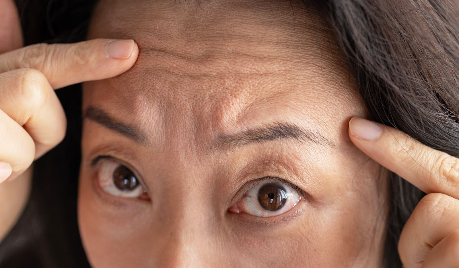 おでこのしわを指差す女性