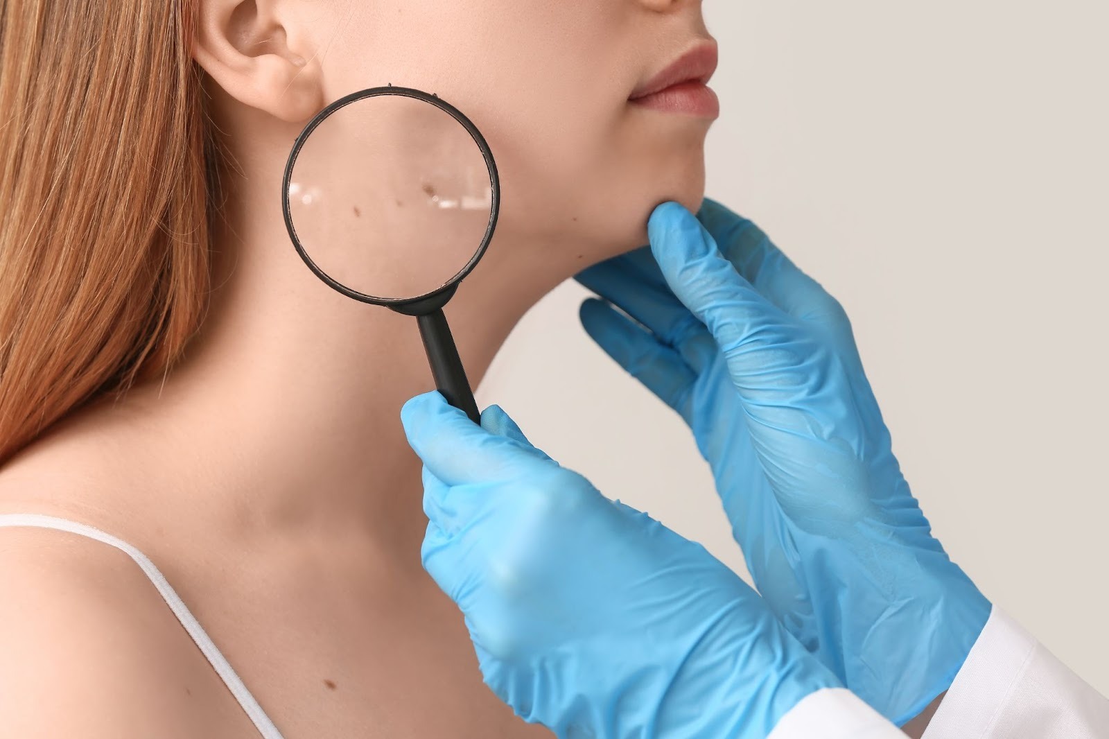 女性の肌のシミを医師が虫眼鏡を持ってチェックしている様子