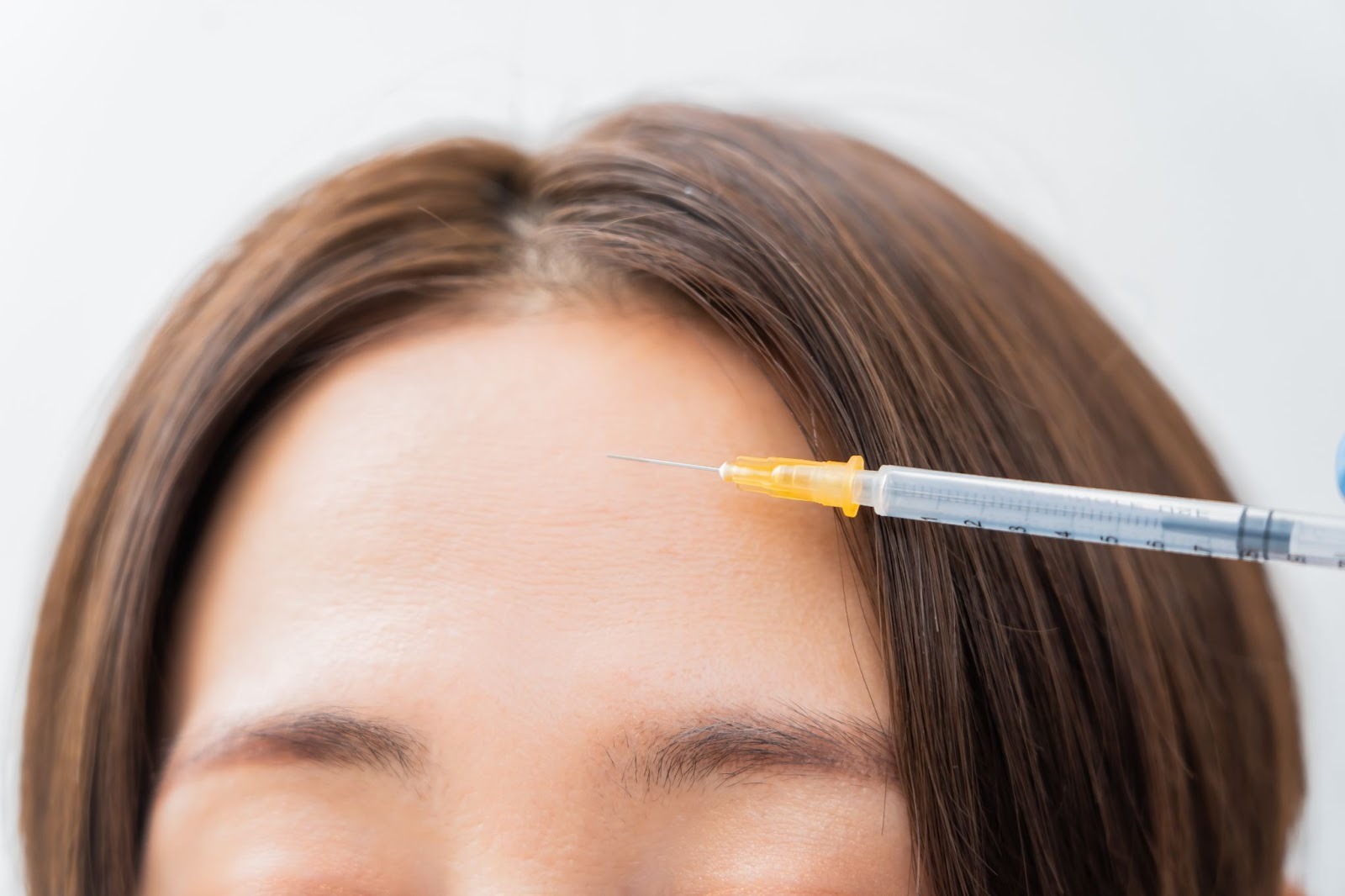 おでこのしわを注射治療で治療している様子