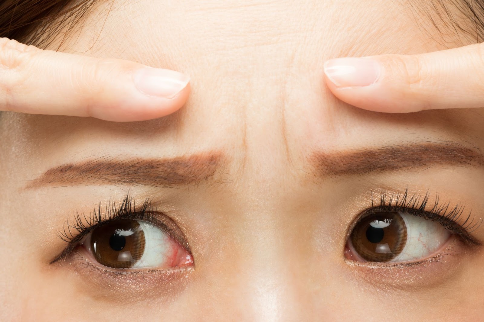 おでこのしわを両手の人差し指で指さしている