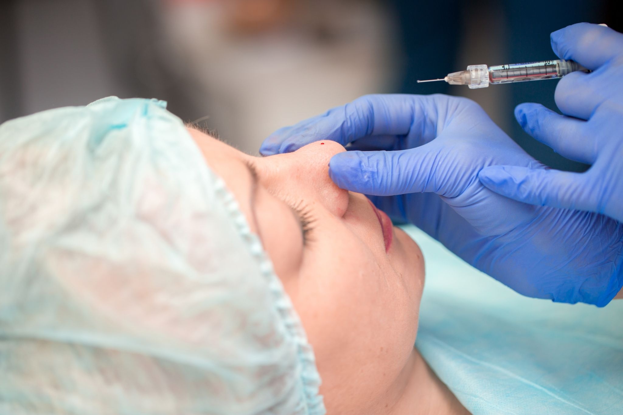 鼻ヒアルロン酸の施術を受けている女性