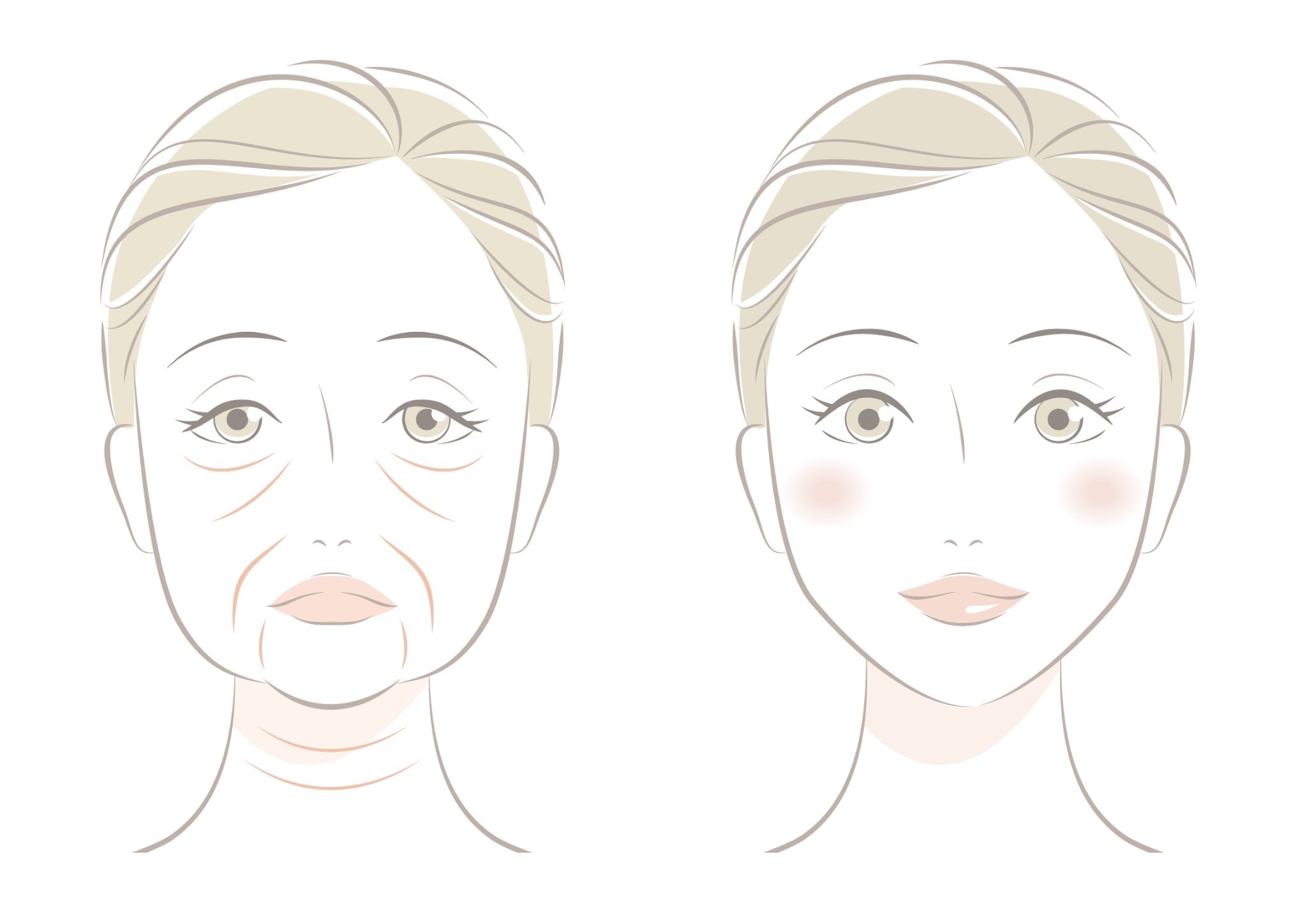 たるみがある女性とたるみのない女性のイラスト